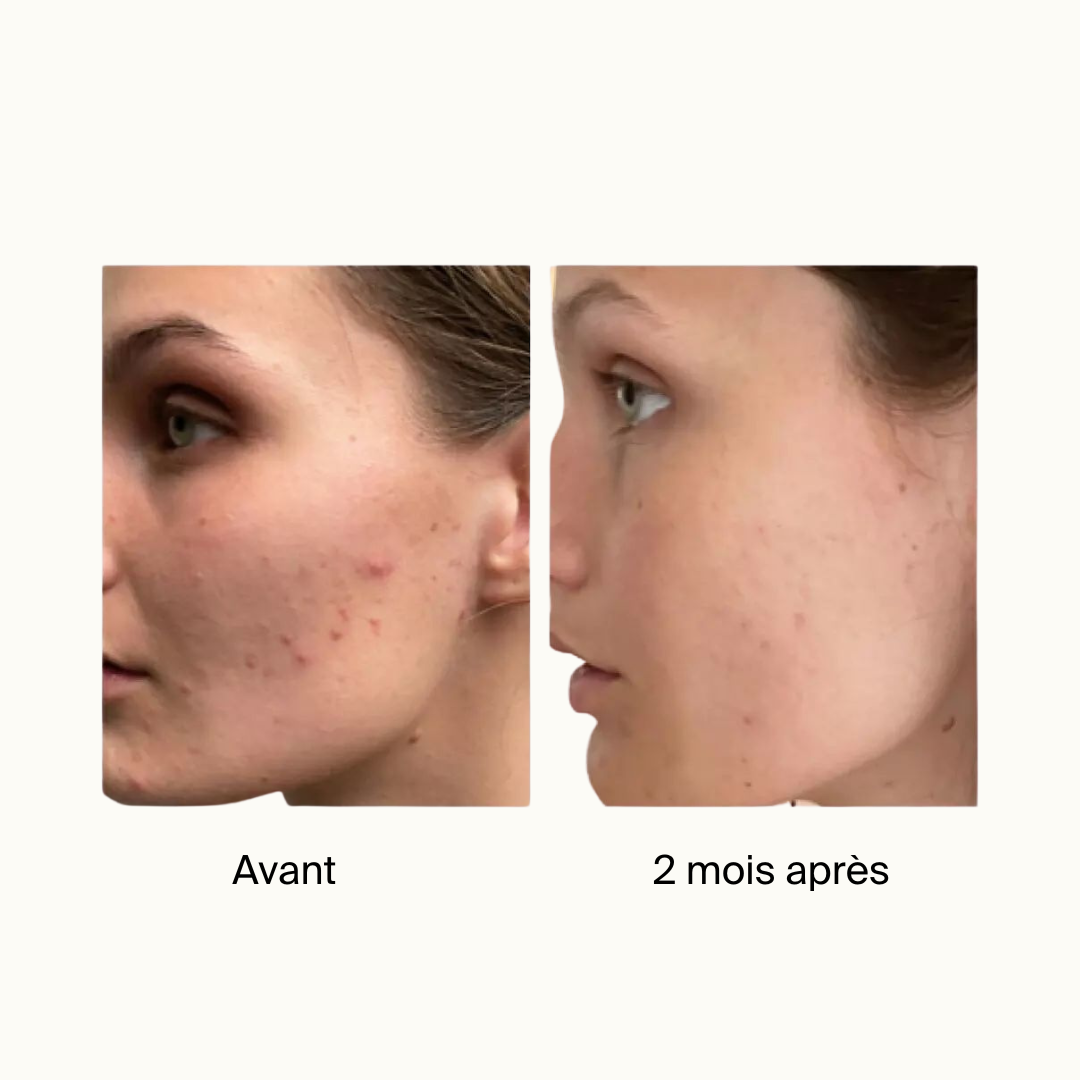Sérum Anti-Imperfections Visage 2% BHA
